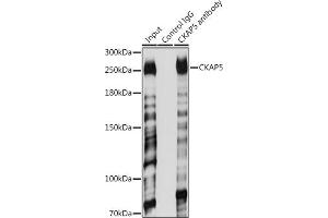 Immunoprecipitation analysis of 200 μg extracts of Jurkat cells using 3 μg CK antibody (ABIN6127628, ABIN6138647, ABIN6138648 and ABIN6224627). (CKAP5 antibody  (AA 1763-2032))