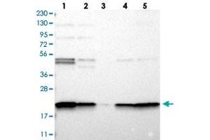 Western blot analysis of Lane 1: RT-4, Lane 2: U-251 MG, Lane 3: Human Plasma, Lane 4: Liver, Lane 5: Tonsil with TMEM109 polyclonal antibody  at 1:250-1:500 dilution. (TMEM109 antibody)