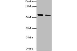 Western blot All lanes: ADSL antibody at 2 μg/mL Lane 1: Hela whole cell lysate Lane 2: Mouse heart tissue Secondary Goat polyclonal to rabbit IgG at 1/10000 dilution Predicted band size: 55, 49 kDa Observed band size: 55 kDa