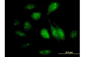 Immunofluorescence of purified MaxPab antibody to GTPBP4 on HeLa cell.
