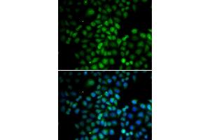 Immunofluorescence analysis of HeLa cells using C11orf30 antibody (ABIN6127845, ABIN6137722, ABIN6137724 and ABIN6217721). (EMSY antibody  (AA 1153-1322))