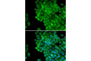 Immunofluorescence analysis of HeLa cells using MAGE-1/MA antibody (ABIN6132325, ABIN6143435, ABIN6143436 and ABIN6221133). (MAGEA1 antibody  (AA 1-309))