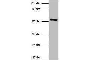 Western blot All lanes: CAMK4 antibody at 2 μg/mL + 293T whole cell lysate Secondary Goat polyclonal to rabbit IgG at 1/10000 dilution Predicted band size: 52 kDa Observed band size: 52 kDa (CAMK4 antibody  (AA 304-473))