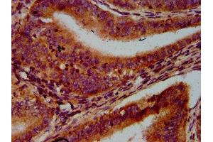 Immunohistochemistry (IHC) image for anti-Late Endosomal/lysosomal Adaptor, MAPK and mTOR Activator 1 (LAMTOR1) (AA 2-161) antibody (ABIN7167068)