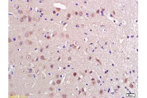Formalin-fixed and paraffin embedded rat brain labeled with Anti-PRL Polyclonal Antibody, Unconjugated (ABIN669456) at 1:200 followed by conjugation to the secondary antibody and DAB staining.