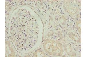 Immunohistochemistry (IHC) image for anti-Sarcoglycan, alpha (50kDa Dystrophin-Associated Glycoprotein) (SGCA) (AA 24-290) antibody (ABIN7143931)