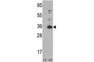 Western blot analysis of CDK4 antibody and 293 cell lysate (2 ug/lane) either nontransfected (Lane 1) or transiently transfected with the CDK4 gene (2). (CDK4 antibody  (AA 273-305))