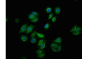 Immunofluorescence staining of HepG2 cells with ABIN7127737 at 1:100,counter-stained with DAPI. (Recombinant RAF1 antibody  (pSer259))