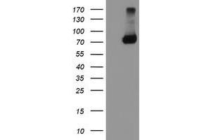 Western Blotting (WB) image for anti-TNF Receptor-Associated Protein 1 (TRAP1) antibody (ABIN1501500) (TRAP1 antibody)