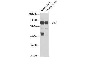 Western blot analysis of extracts of various cell lines, using BTD antibody (ABIN6127510, ABIN6137680, ABIN6137682 and ABIN6221882) at 1:1000 dilution.