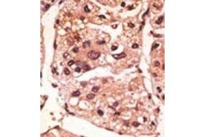 Immunohistochemistry (Paraffin-embedded Sections) (IHC (p)) image for anti-Presenilin 1 (PSEN1) (AA 330-359), (C-Term) antibody (ABIN390169)