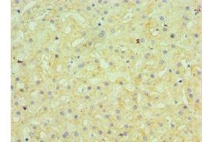 Immunohistochemistry of paraffin-embedded human liver tissue using ABIN7145506 at dilution of 1:100 (Glucuronidase beta antibody  (AA 382-651))