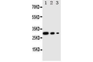 Lane 3: Recombinant Human CRTC1 Protein 2. (CRTC1 antibody  (C-Term))