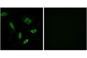 Immunofluorescence analysis of A549 cells, using SLC27A5 Antibody. (SLC27A5 antibody  (AA 481-530))