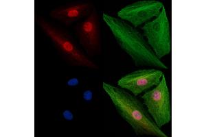 ABIN7094796 and ABIN7098847 staining  cells by IF/ICC. (SF3B1 antibody  (N-Term))