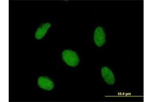 Immunofluorescence of purified MaxPab antibody to SAP30 on HeLa cell. (SAP30 antibody  (AA 1-220))