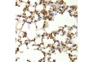 Immunohistochemistry of paraffin-embedded mouse lung using TAF1C Antibody.