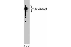 Western blot analysis of CD45 on a Jurkat cell lysate (Human T-cell leukemia, ATCC TIB-152). (CD45 antibody  (AA 535-730))
