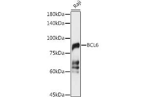 Western blot analysis of extracts of Raji cells, using BCL6 antibody (ABIN6130002, ABIN6137511, ABIN6137512 and ABIN6222987) at 1:1000 dilution. (BCL6 antibody  (AA 1-280))