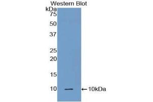 Detection of Recombinant C5a, Mouse using Polyclonal Antibody to Complement Component 5a (C5a) (C5A antibody  (AA 679-755))