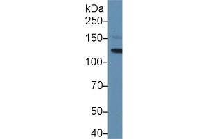 Western blot analysis of Mouse Serum, using Mouse LIFR Antibody (1 µg/ml) and HRP-conjugated Goat Anti-Rabbit antibody ( (LIFR antibody  (AA 641-790))