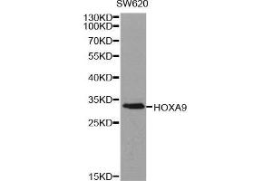 Western blot analysis of extracts of SW620 cell line, using HOXA9 antibody. (HOXA9 antibody  (AA 1-190))