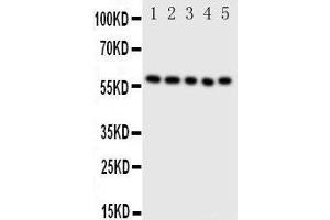 Anti-ERp57 antibody, Western blotting Lane 1: SMMC Cell Lysate Lane 2: A549 Cell Lysate Lane 3: U87 Cell Lysate Lane 4: HELA Cell Lysate Lane 5: MCF-7 Cell Lysate (PDIA3 antibody  (Middle Region))