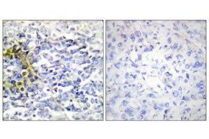 Immunohistochemistry (IHC) image for anti-Fragile X Mental Retardation, Autosomal Homolog 2 (FXR2) (C-Term) antibody (ABIN1849412) (FXR2 antibody  (C-Term))