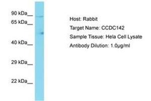Image no. 1 for anti-Coiled-Coil Domain Containing 142 (CCDC142) (AA 658-707) antibody (ABIN6750704) (CCDC142 antibody  (AA 658-707))