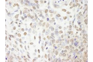 Immunohistochemistry (IHC) image for anti-Cleavage and Polyadenylation Specific Factor 2, 100kDa (CPSF2) (AA 450-500) antibody (ABIN7448485) (CPSF2 antibody  (AA 450-500))