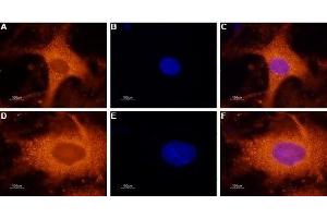 Expression of Galanin receptor 1 in rat DRG - Immunocytochemical staining of GALR1 in a primary culture of rat dorsal root ganglion (DRG) neurons. (Galanin Receptor 1 antibody  (1st Extracellular Loop))