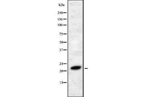 Western blot analysis FGF4 using RAW264. (FGF4 antibody  (Internal Region))
