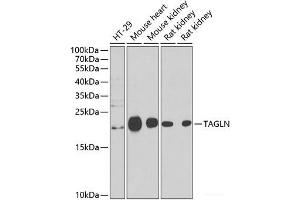 Western blot analysis of extracts of various cell lines using TAGLN Polyclonal Antibody at dilution of 1:1000. (Transgelin antibody)