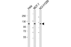 All lanes : Anti-P1R13L Antibody (Center) at 1:2000 dilution Lane 1: Hela whole cell lysates Lane 2: MCF-7 whole cell lysates Lane 3: NCI- whole cell lysates Lysates/proteins at 20 μg per lane. (PPP1R13L antibody  (AA 455-485))