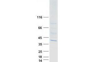 Western Blotting (WB) image for WD Repeat Domain 83 (wdr83) (Transcript Variant 2) protein (Myc-DYKDDDDK Tag) (ABIN2726270)