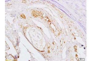 Immunohistochemistry (Paraffin-embedded Sections) (IHC (p)) image for anti-Bone Morphogenetic Protein Receptor 1A (BMPR1A) (AA 101-200) antibody (ABIN687547)