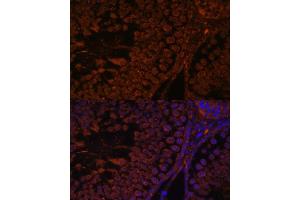 Immunofluorescence analysis of rat testis using TPD52L3 antibody (ABIN7271079) at dilution of 1:100. (TPD52L3 antibody  (AA 1-132))