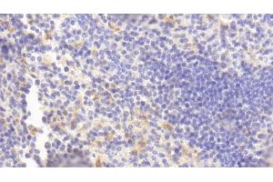 Immunohistochemistry (IHC) image for anti-Ficolin (Collagen/fibrinogen Domain Containing) 1 (FCN1) (AA 25-317) antibody (ABIN7432607)