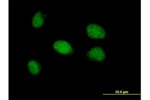 Immunofluorescence of purified MaxPab antibody to CDYL2 on HeLa cell. (CDYL2 antibody  (AA 1-506))