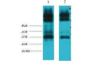 Western Blotting (WB) image for anti-EF-Hand Domain Family, Member D1 (EFHD1) antibody (ABIN3178638) (EFHD1 antibody)