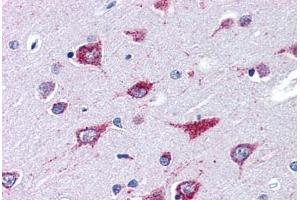 Human Brain, Cortex (formalin-fixed, paraffin-embedded) stained with ALS2 antibody ABIN351462 at 3. (ALS2 antibody  (AA 1644-1657))