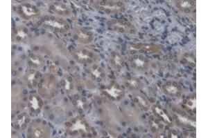 DAB staining on IHC-P; Samples: Rat Kidney Tissue (NEU2 antibody  (AA 185-379))