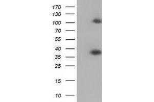 HEK293T cells were transfected with the pCMV6-ENTRY control (Left lane) or pCMV6-ENTRY ZFP36 (Right lane) cDNA for 48 hrs and lysed. (ZFP36 antibody)