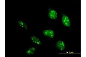 Immunofluorescence of purified MaxPab antibody to POLR1D on HeLa cell.