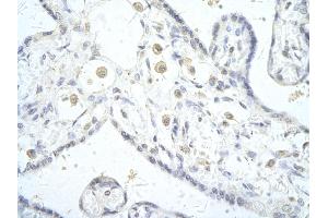 Rabbit Anti-DLX5 antibody        Paraffin Embedded Tissue:  Human Placenta cell   Cellular Data:  Epithelial cells of renal tubule  Antibody Concentration:   4. (DLX5 antibody  (C-Term))