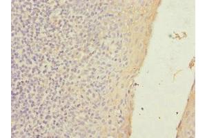 Immunohistochemistry of paraffin-embedded human tonsil tissue using ABIN7170174 at dilution of 1:100 (SLC23A2 antibody  (AA 1-90))