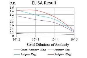 Black line: Control Antigen (100 ng), Purple line: Antigen(10 ng), Blue line: Antigen (50 ng), Red line: Antigen (100 ng), (CA9 antibody  (AA 37-186))