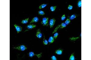 IF analysis of MTHFD1L using anti-MTHFD1L antibody (ABIN7601728). (MTHFD1L antibody  (AA 43-833))