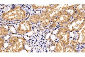 Detection of IL10Rb in Human Kidney Tissue using Polyclonal Antibody to Interleukin 10 Receptor Beta (IL10Rb) (IL10RB antibody  (AA 87-243))