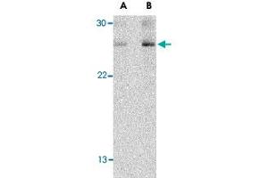 Western blot analysis of TSLP in Jurkat cell lysate with TSLP polyclonal antibody  at (A) 1 and (B) 2 ug/mL . (Thymic Stromal Lymphopoietin antibody  (C-Term))